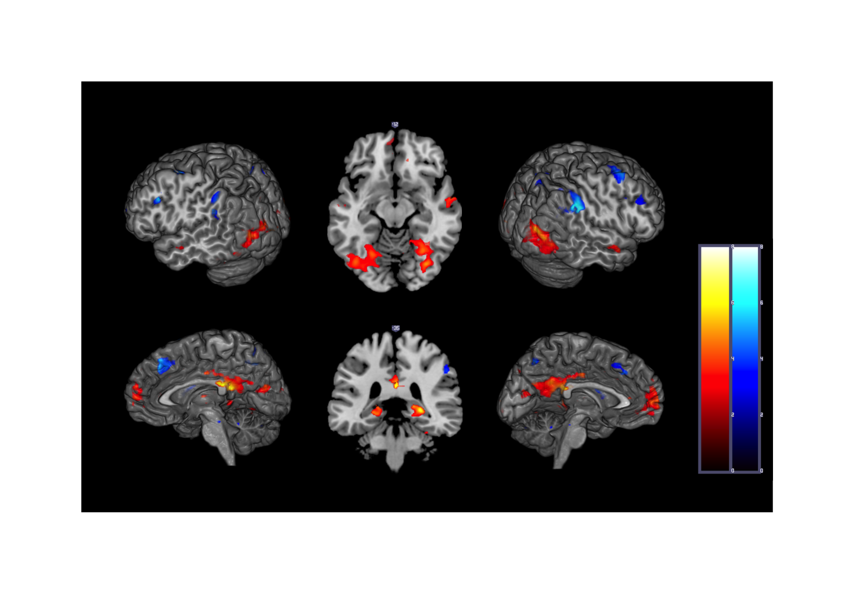 Our study (in prep.) showed that visuospatial recursion requires integration of spatial and semantic processing systems.